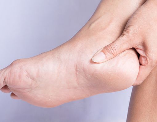 4 Cara Alami Menghilangkan Bekas Luka di Kaki Selain Menggunakan Obat Medis