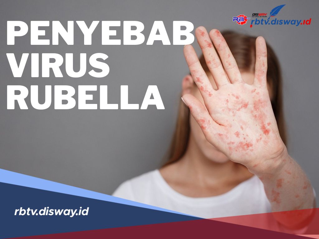 Ini Penyebab Virus Rubella, Waspada Karena Cepat Menular Ke Ibu Hamil dan Anak-anak