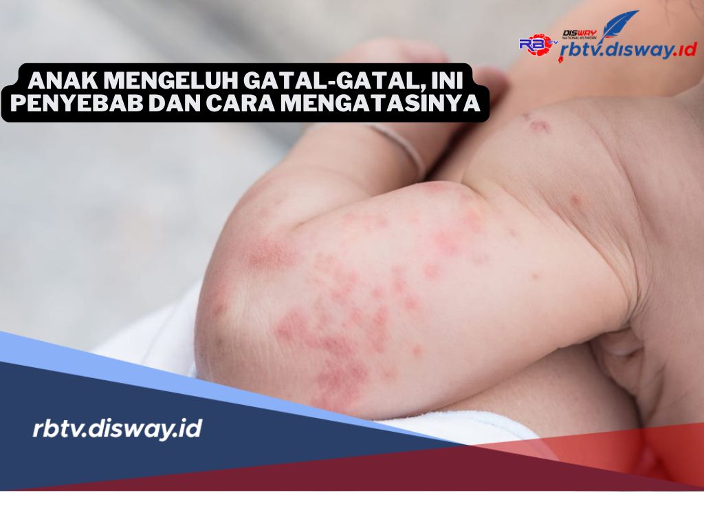 Buat Bunda, Kenali Penyebab dan Cara Mengatasi Keluhan Gatal Pada Anak Anda