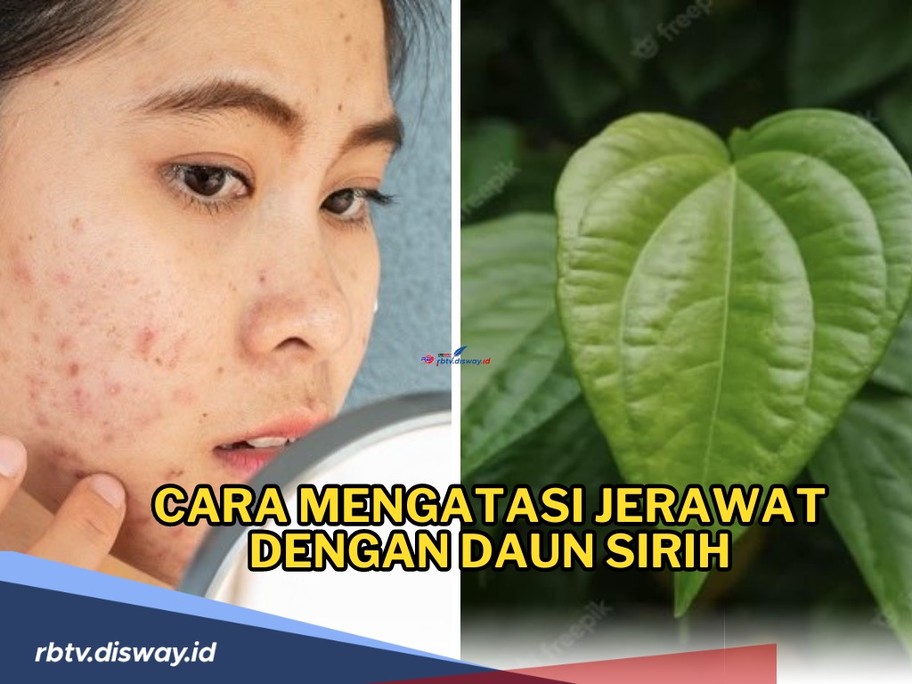 Ini Cara Mengatasi Jerawat dengan Daun Sirih Mudah dan Alami, Sudah Tahu Belum? 