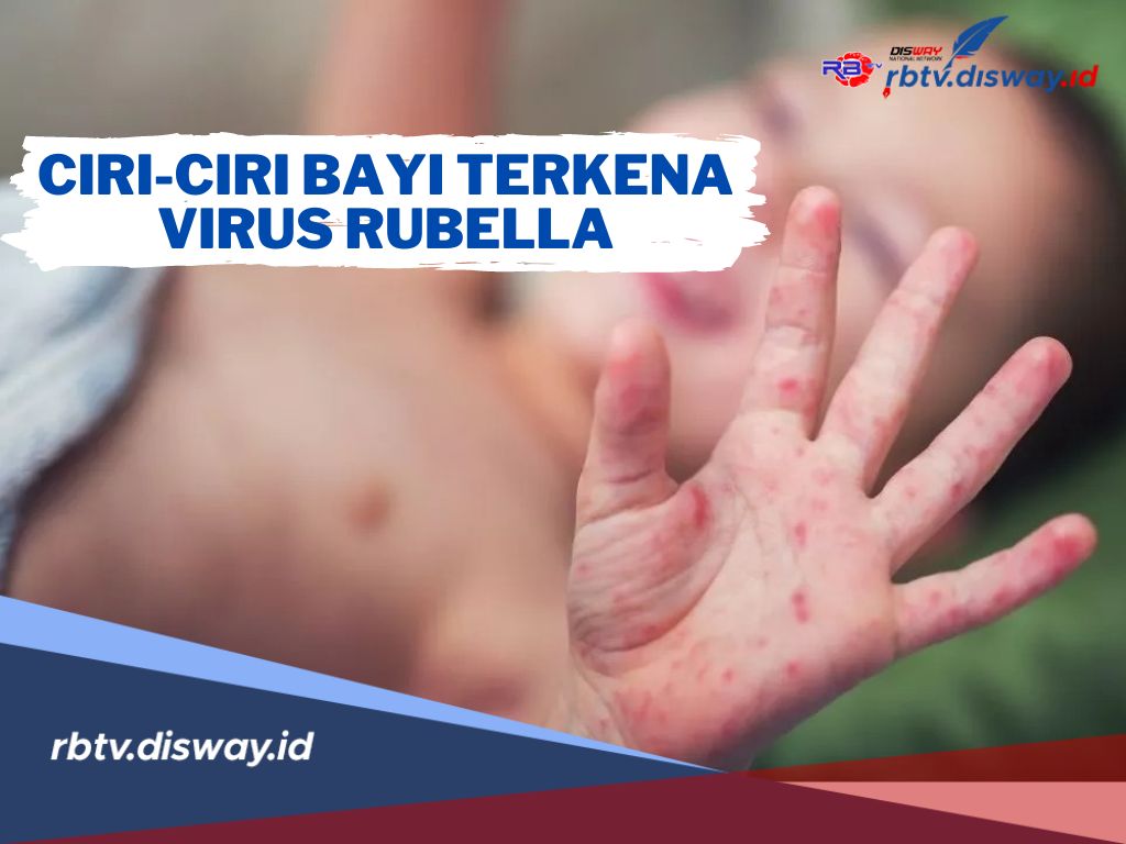 8 Ciri-ciri Bayi Terkena Virus Rubella, Salah Satunya Ruam dengan Bentuk Bintik-bintik Kemerahan