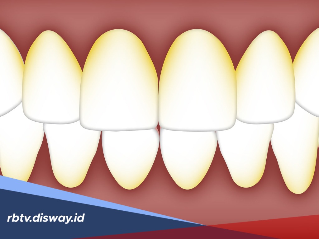 Tak Perlu ke Dokter? Begini 10 Cara Alami Bersihkan Plak Gigi