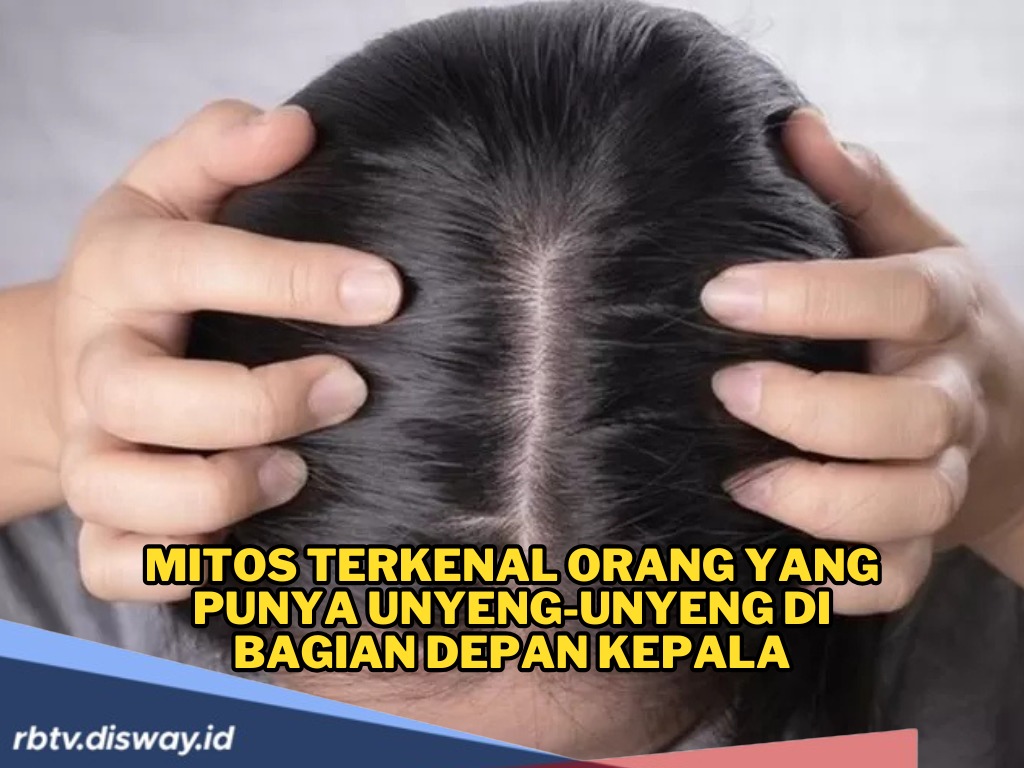 Mitos Terkenal Orang yang Punya Unyeng-Unyeng di Bagian Depan Kepala, Katanya Mudah Tersambar Petir?