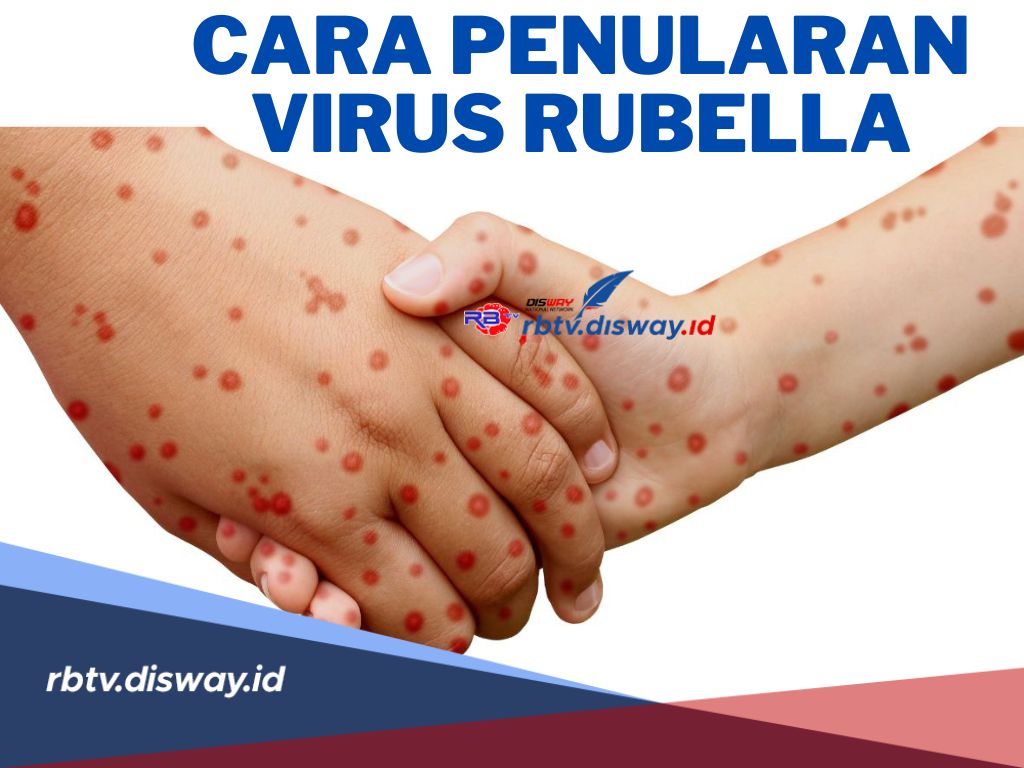 Begini Cara Penularan Virus Rubella, Harus Diwaspadai Terutama Ibu Hamil