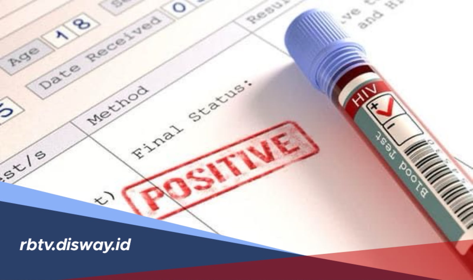 HIV dan AIDS: Kenali Perbedaan, Gejala serta Cara Penularannya