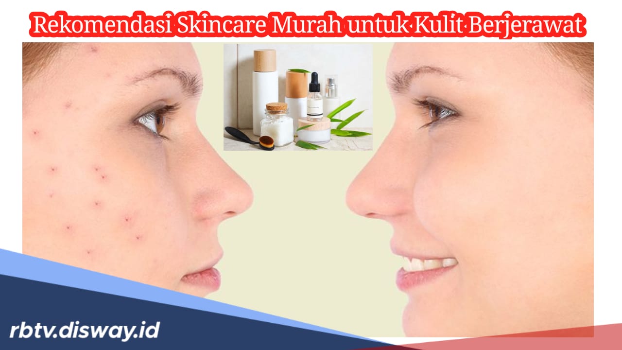 Ini 8 Rekomendasi Skincare Murah Cocok untuk Wajah Berjerawat, Harganya Cuma Segini