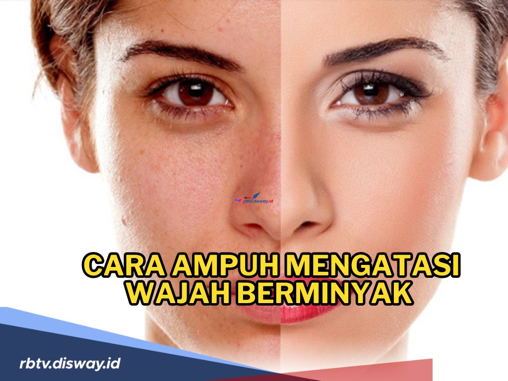 Ini 11 Cara Ampuh Mengatasi Wajah Berminyak Secara Alami, Bye-bye Minyak di Wajah! 