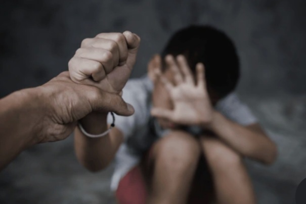 Bocah 11 Tahun Diduga Dianiaya Oknum Pengurus Masjid Pakai Kayu hingga Terluka dan Muntah