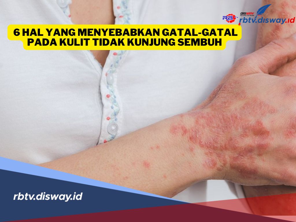 Jangan Dianggap Sepele, Ini 6 Hal yang Menyebabkan Gatal-gatal Pada Kulit Tidak Kunjung Sembuh
