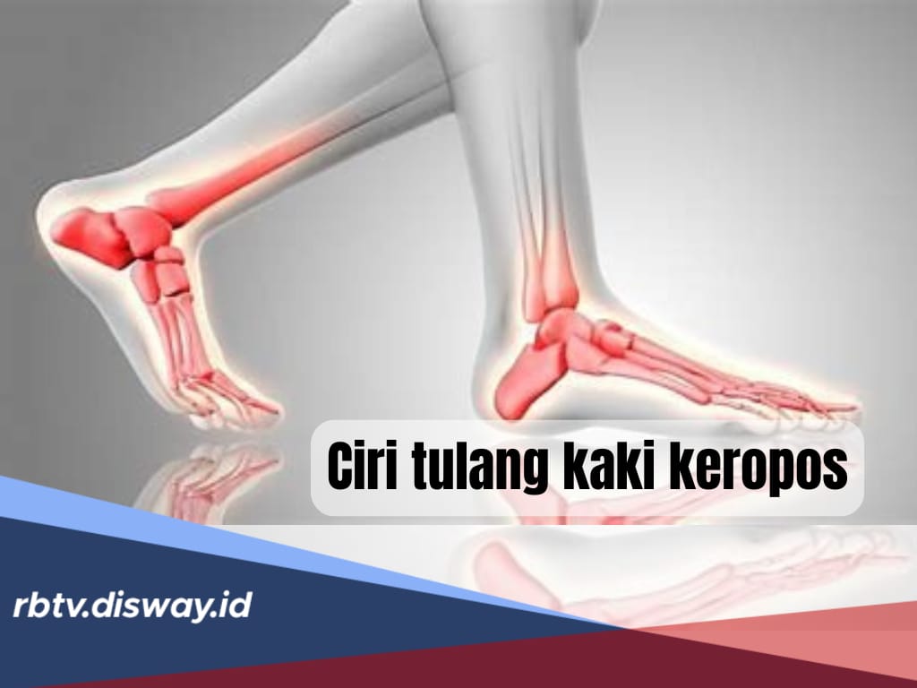 5 Ciri Tulang Kaki Keropos, Kenali Faktor Penyebab Terjadi Osteoporosis 