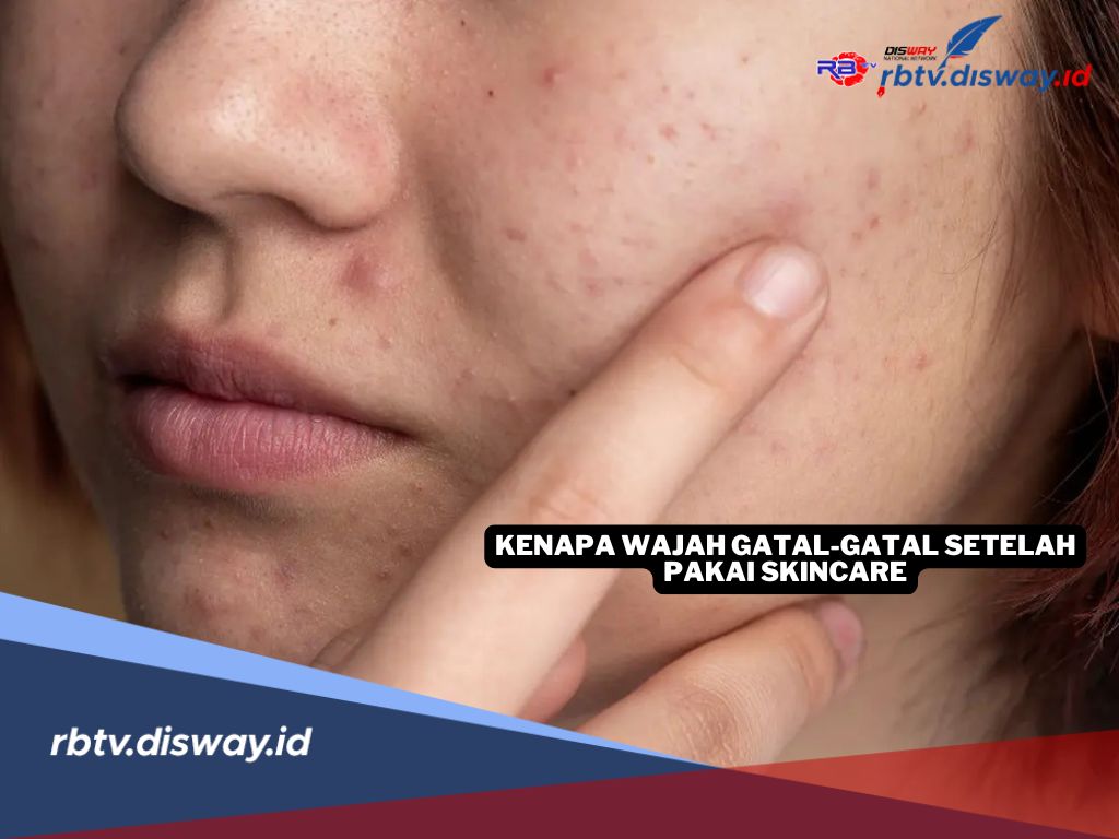 Penyebab Wajah Gatal Setelah Pakai Skincare, Ini Solusinya