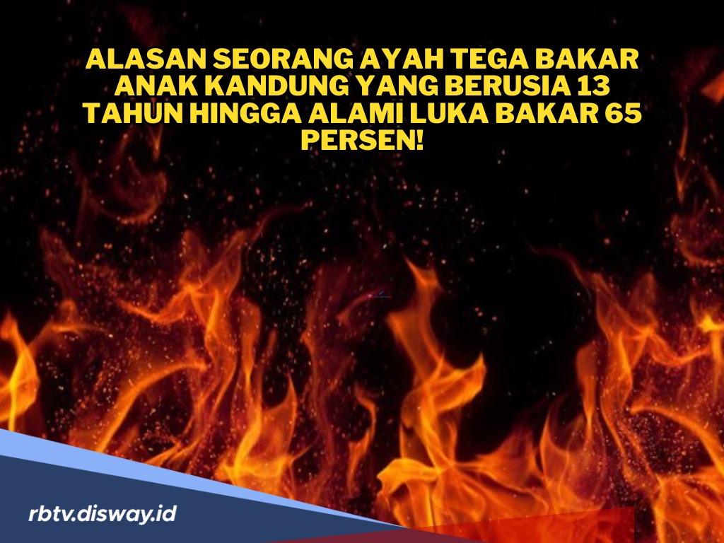 Seorang Ayah Tega Bakar Anak Gadisnya hingga Alami Luka Bakar 65 Persen, Penyebabnya Karena Ini