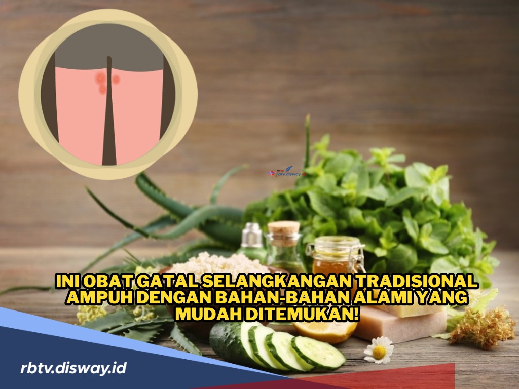 Ini Obat Gatal Selangkangan Tradisional dengan Bahan-bahan Alami yang Mudah Ditemukan!