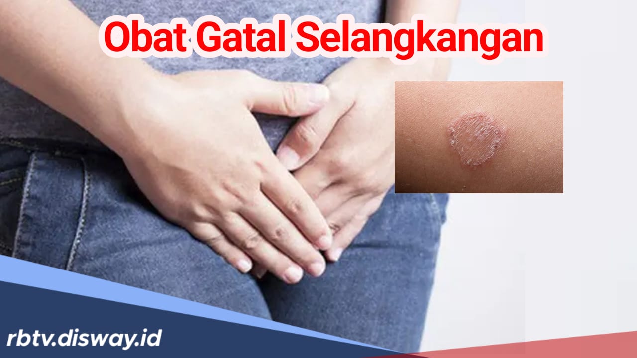 Awas Jangan Digaruk! Ini Obat Gatal Selangkangan Ampuh yang Dijual di Apotek