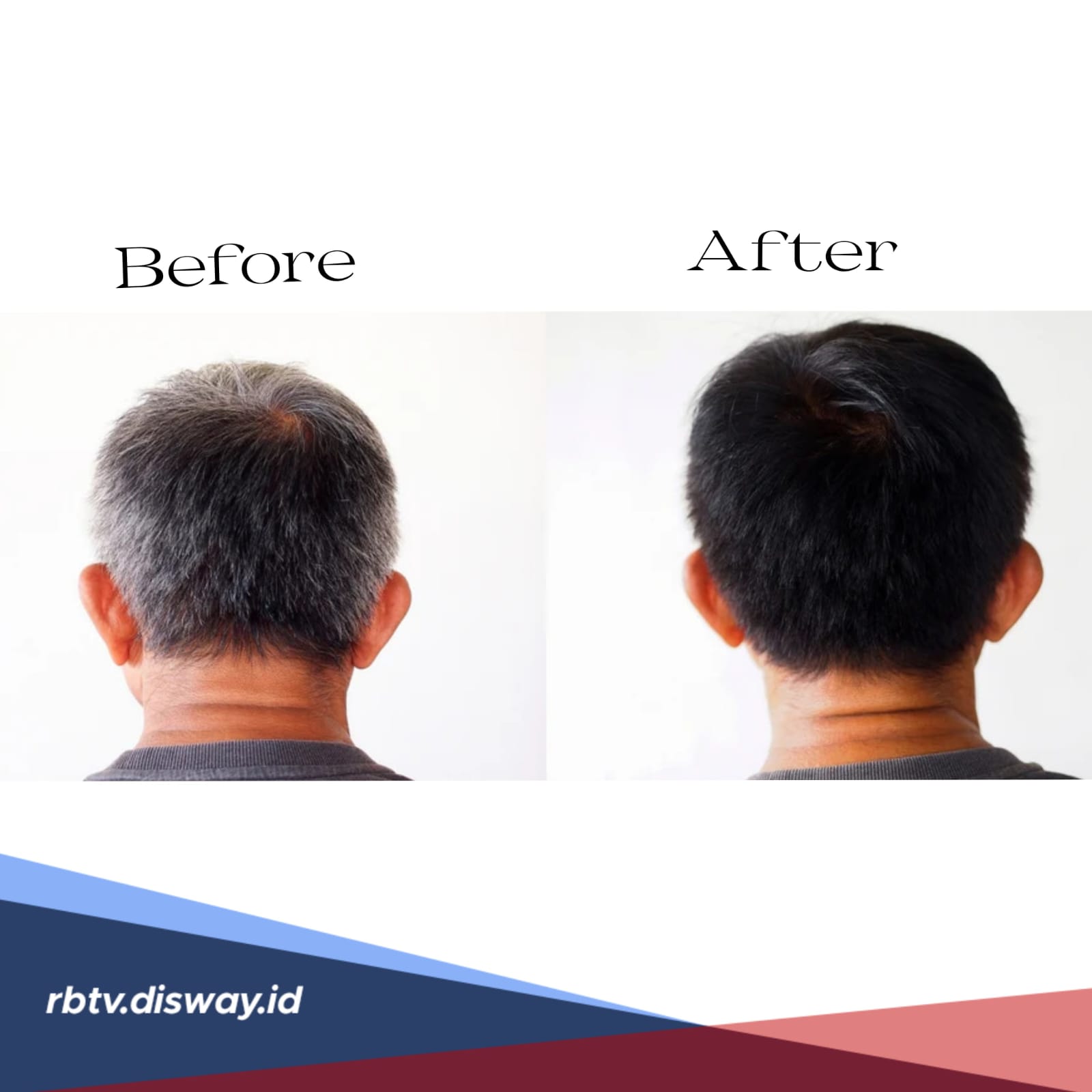 Bukan Dicat Apalagi Disemir, Ini Cara Menghilangkan Uban dengan Bahan Alami