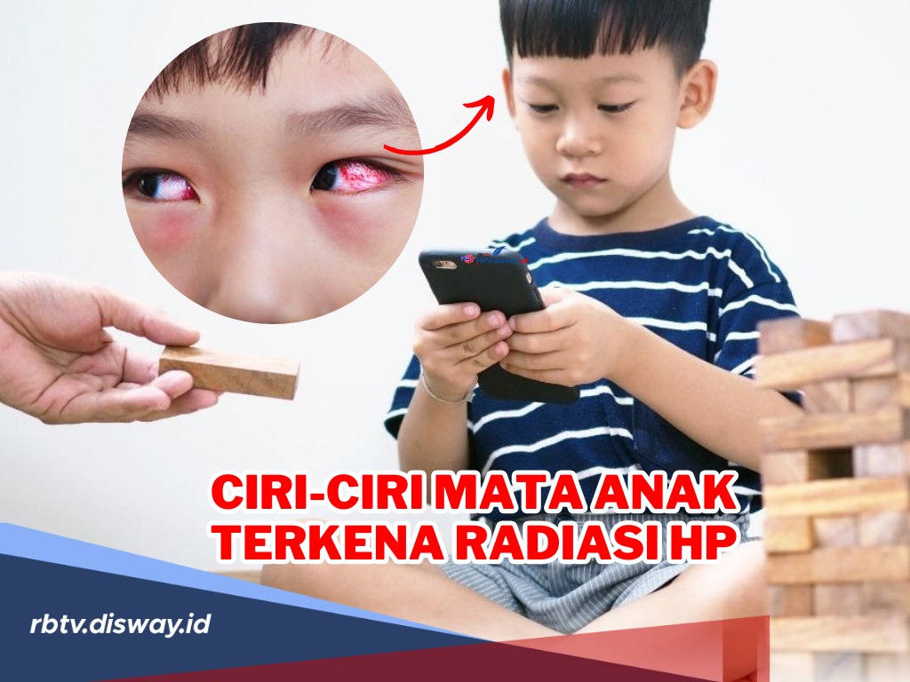 Waspada Anak Main Hp! Ini Ciri-ciri Mata Anak Terkena Radiasi Hp serta Cara Pencegahan Radiasi