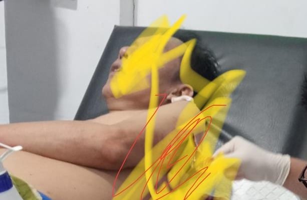 Kades Padang Genteng Kaur Kena Bacok, Lengan dan Punggung Terluka