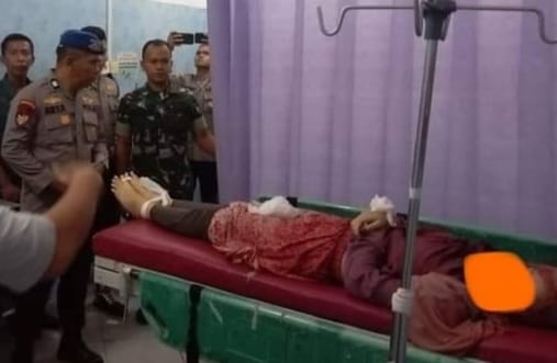 Jatuh dari Jetski di Pantai Carocok Painan, Gadis 13 Tahun Asal Bengkulu Meninggal Dunia