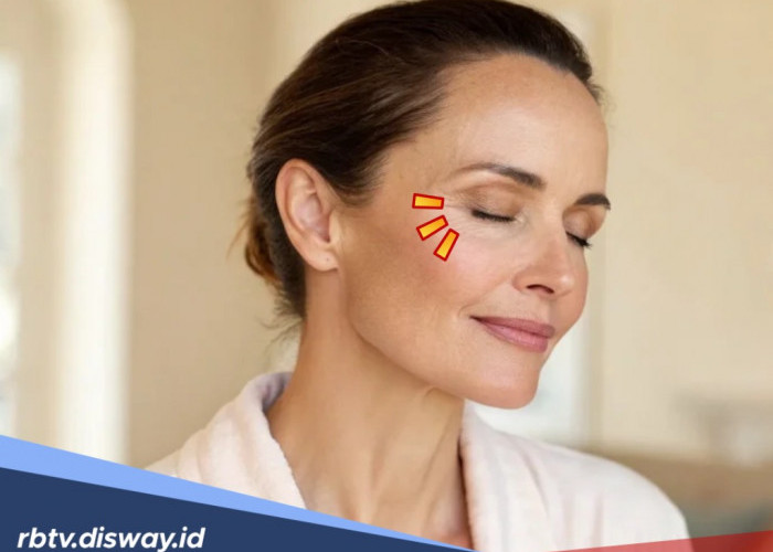 Cara Menghilangkan Kerutan di Bawah Mata Secara Alami Tanpa Suntik Botox atau Filler