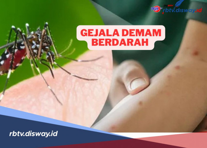 Penyakit Mematikan! Kenali Ini Gejala Demam Berdarah Dengue (DBD)