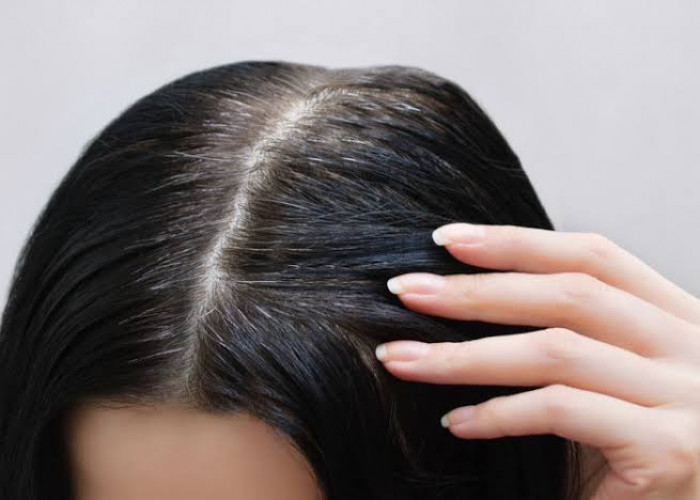 Hasilnya Bikin Kagum, Ini Manfaat Daun Pandan Untuk Kesehatan Rambut dan Cara Mengolahnya