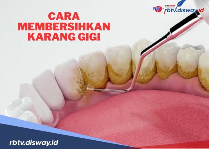 7 Cara Membersihkan Karang Gigi Membandel, Dijamin Ampuh dan Aman