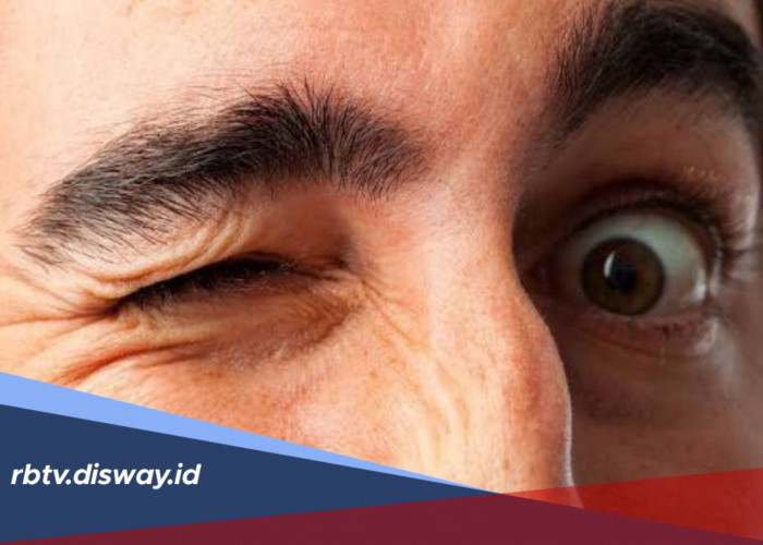 Jangan Salah Artikan, Ini Penyebab Mata Sering Kedutan
