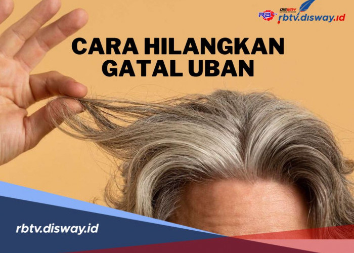 Terbukti Ampuh, Ini Cara Mengatasi Gatal di Kepala Karena Uban, Yuk Dicoba!
