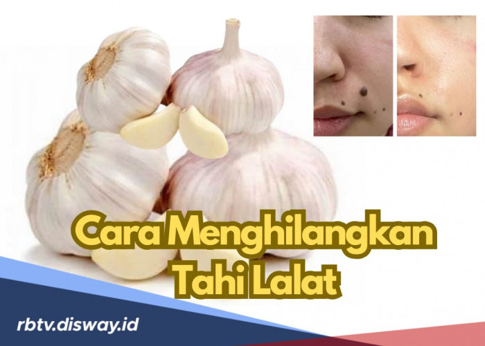 7 Cara Menghilangkan Tahi Lalat dengan Mudah dan Efektif, Salah Satunya Pakai Bawang Putih