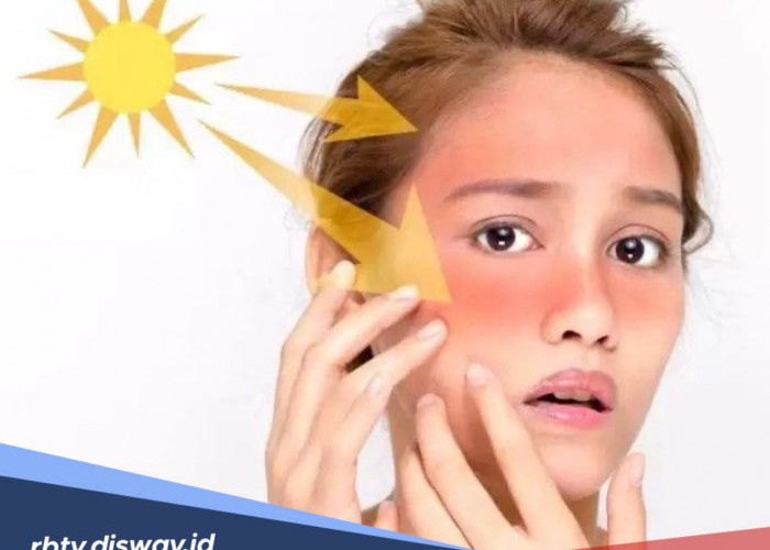 Manfaat Sunscreen untuk Kulit Wajah Sangat Penting! Jangan Sampai Terlewat