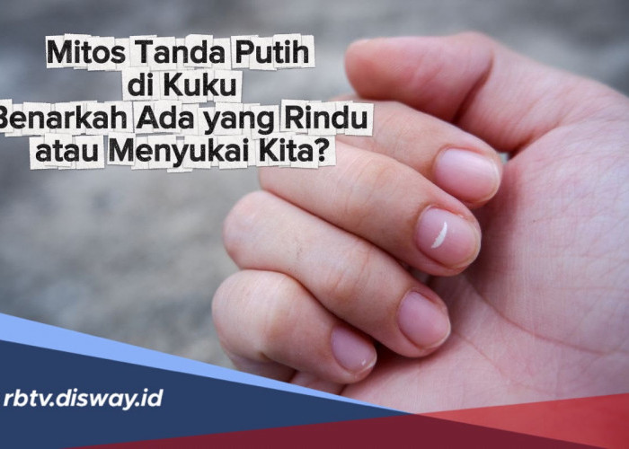 Mitos Tanda Putih di Kuku: Benarkah Ada yang Rindu atau Menyukai Kita?