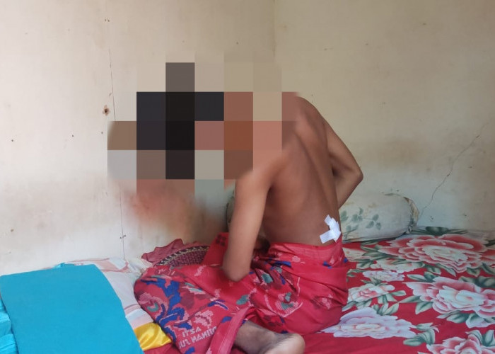 Puluhan OTD Membabi-buta di Padang Jati, Satu Warga Tidak Bersalah Turut Jadi Korban, Luka Bagian Perut 