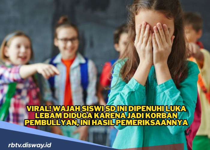 Wajah Penuh Luka Lebam, Siswi SD Berkebutuhan Khusus Diduga Jadi Korban Perundungan, Ini Hasil Pemeriksaan