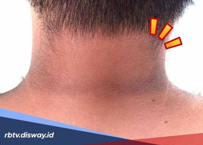 4 Cara Alami Cerahkan Kulit Leher yang Gelap Supaya Terang