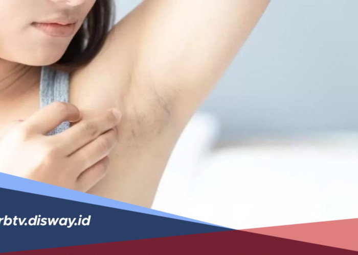 Ada Benjolan di Ketiak yang Tidak Sakit? Waspada Jika Muncul dengan Gejala Ini