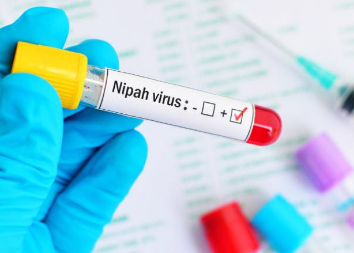 Virus Nipah Sedang Merebak di India, Sudah Terdeteksi di Indonesia?