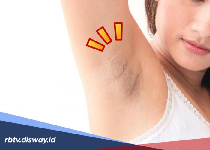 4 Cara Alami Cerahkan Kulit Ketiak yang Hitam Tanpa Perwatan Dokter