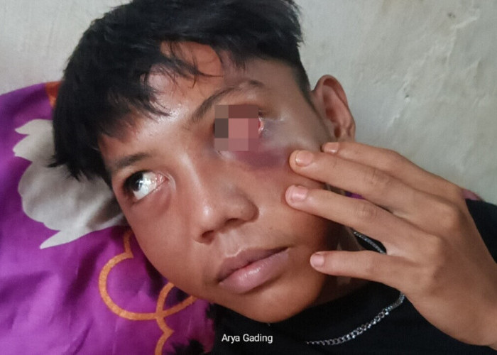 3 Pemuda Sembayat Seluma Babak Belur Usai Nonton Orgen Tunggal di Acara Pesta Pernikahan