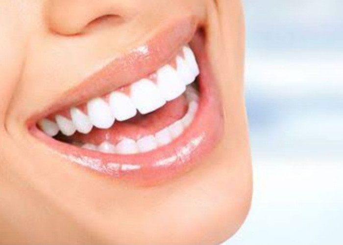 Tak Perlu ke Dokter, Begini Cara Alami Menghilangkan Karang Gigi, Aman dan Mudah