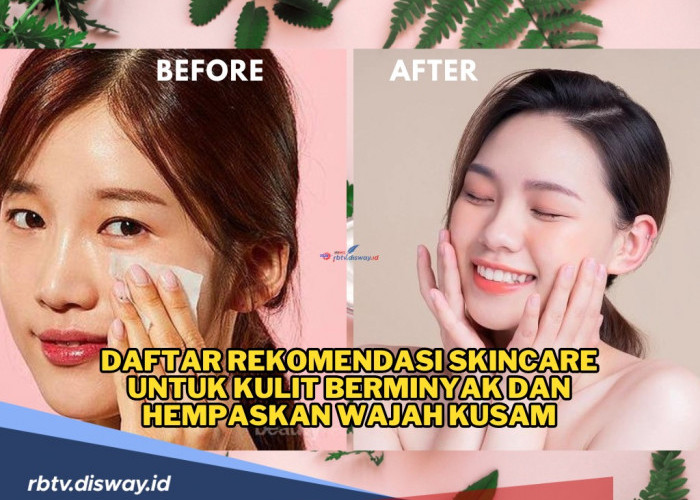 Ini Daftar Rekomendasi Skincare untuk Kulit Berminyak dan Hempaskan Wajah Kusam, Harganya Affordable