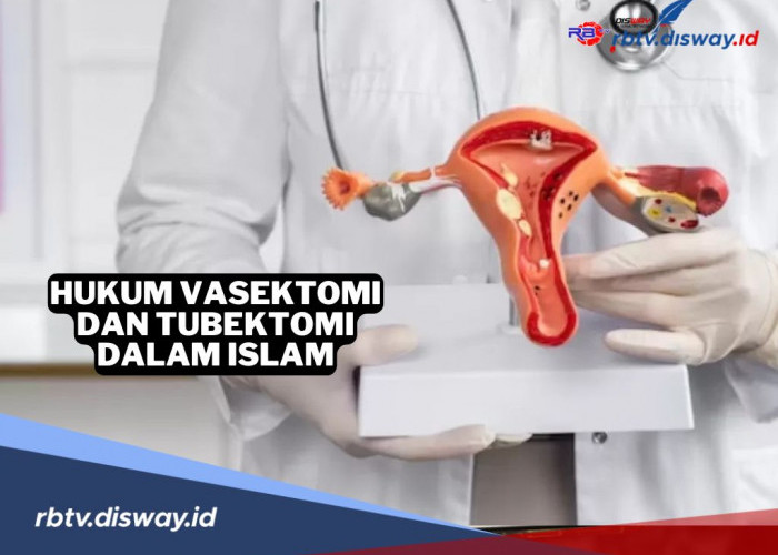 KB Permanen! Ini Hukum Vasektomi dan Tubektomi Menurut Islam