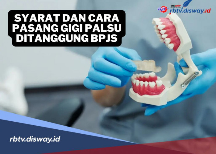Pasang Gigi Palsu Ditanggung BPJS! Yuk, Simak Ini Syarat dan Cara Mendapatkannya!