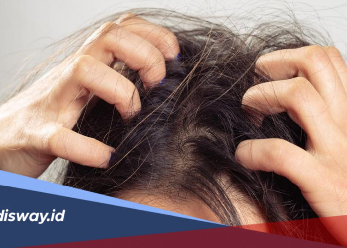 Jangan Digaruk, Coba 5 Bahan Alami Ini untuk Mengatasi Kulit Kepala Gatal