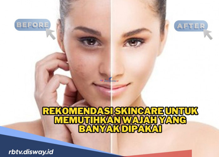 Stop Insecure! Ini Rekomendasi Skincare untuk Memutihkan Wajah, Cocok untuk Remaja