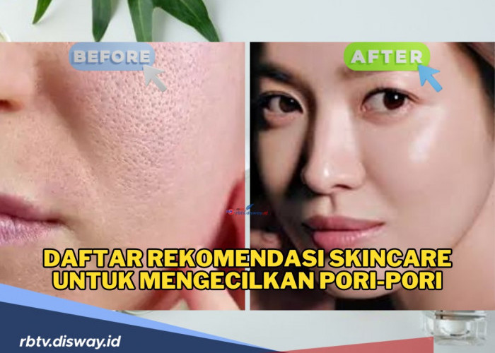 Hai Ciwi-ciwi, Ini Daftar Rekomendasi Skincare untuk Mengecilkan Pori-pori, Wajah Auto Mulus