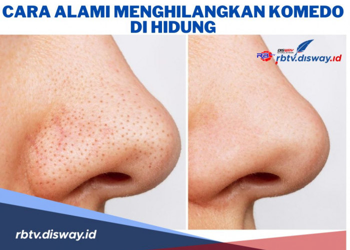 8 Cara Alami Menghilangkan Komedo di Hidung, Coba dan Rasakan Manfaatnya