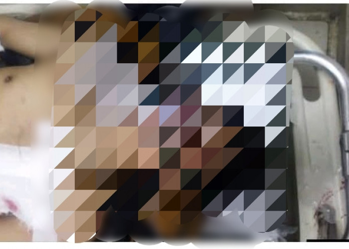 Kondisi Terkini dan Identitas Pemudik yang Jadi Korban Begal di Binduriang Rejang Lebong