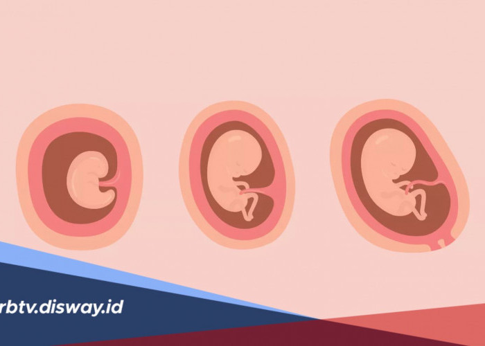 Macam-macam Perubahan yang Dirasakan Wanita Hamil Pada Trimester Satu 