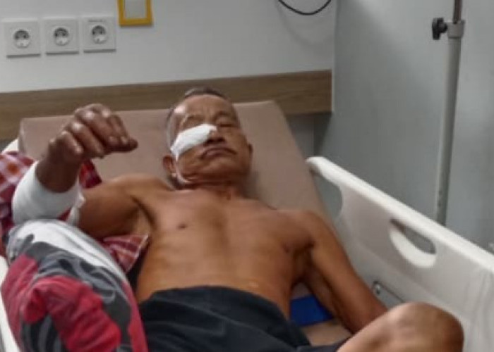 Lansia di Taba Penanjung Bengkulu Tengah Diserang Beruang 