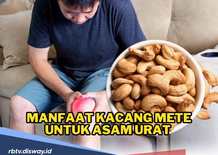 Aman Dikonsumsi, Ini Manfaat Kacang Mete untuk Penderita Asam Urat namun Harus Tahu Cara Konsumsinya 